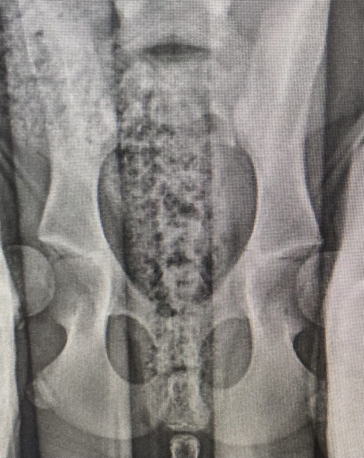 Distraction View Is it hip dysplasia or is it just a puppy sit? | The Hip Health Project